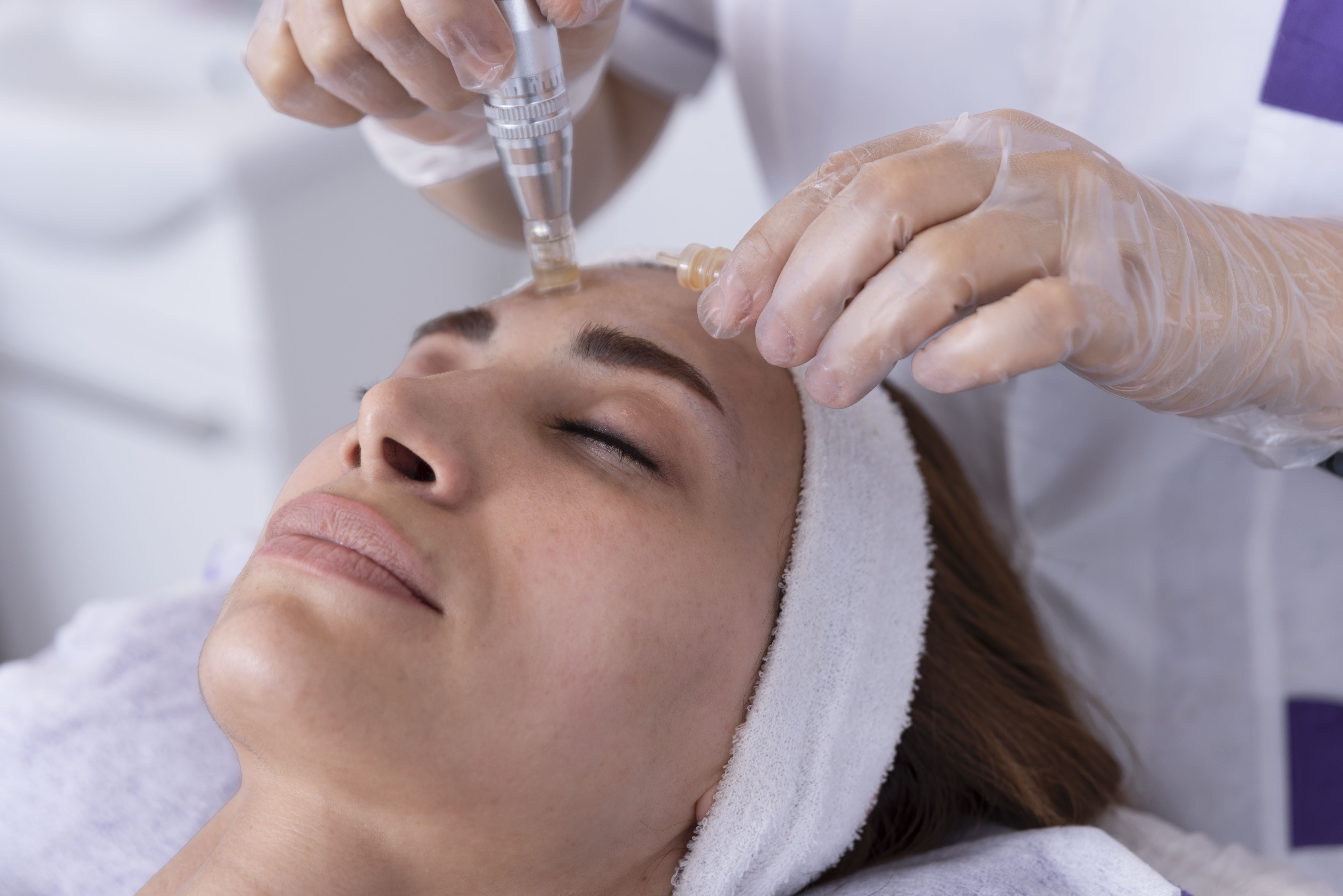 beautician applying facial dermapen treatment on face of young woman